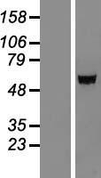 IGSF21 Human Over-expression Lysate