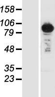 Sts1 (UBASH3B) Human Over-expression Lysate