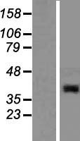 ABHD13 Human Over-expression Lysate