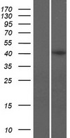 C8orf76 Human Over-expression Lysate