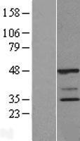 POLR2C Human Over-expression Lysate