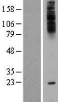 C18orf45 (TMEM241) Human Over-expression Lysate