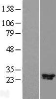 CFAP300 Human Over-expression Lysate