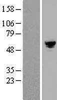 RGH19 (ARHGAP19) Human Over-expression Lysate