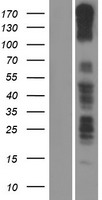 PCDH11X Human Over-expression Lysate