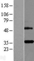 DcR3 (TNFRSF6B) Human Over-expression Lysate