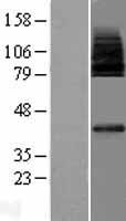 MFSD2A Human Over-expression Lysate