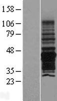 PNMA6A Human Over-expression Lysate