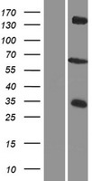 ZDH12 (ZDHHC12) Human Over-expression Lysate