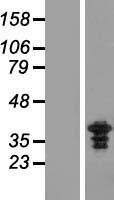 ZWINT Human Over-expression Lysate