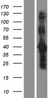 DMRTB1 Human Over-expression Lysate