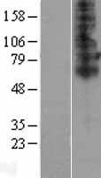 TSCOT (SLC46A2) Human Over-expression Lysate