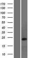 DNAJC5B Human Over-expression Lysate