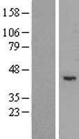 TRIM5 alpha (TRIM5) Human Over-expression Lysate