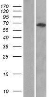 ANKRD13A Human Over-expression Lysate