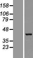 GTPBP10 Human Over-expression Lysate