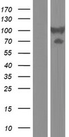 Dystrobrevin beta (DTNB) Human Over-expression Lysate
