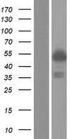 PML Protein (PML) Human Over-expression Lysate