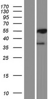 PML Protein (PML) Human Over-expression Lysate