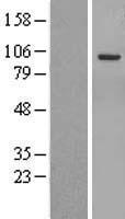IRE1 (ERN2) Human Over-expression Lysate