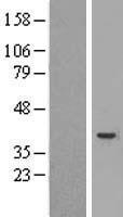 Caspase 4 (CASP4) Human Over-expression Lysate