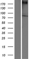 Chorein (VPS13A) Human Over-expression Lysate
