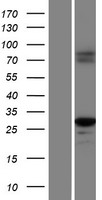 Caspase 1 (CASP1) Human Over-expression Lysate
