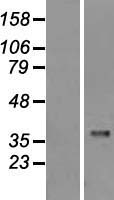 Caspase 1 (CASP1) Human Over-expression Lysate