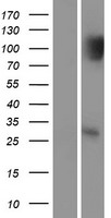 p53 DINP1 (TP53INP1) Human Over-expression Lysate