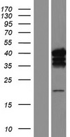 Caspase-7 (CASP7) Human Over-expression Lysate