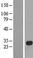 FAM78A Human Over-expression Lysate