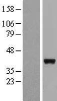 LRRC46 Human Over-expression Lysate