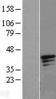 Granzyme H (GZMH) Human Over-expression Lysate