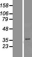 PGAP3 Human Over-expression Lysate