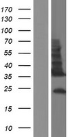 TMEM54 Human Over-expression Lysate