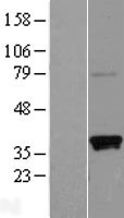 SLAMF9 Human Over-expression Lysate