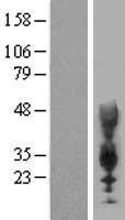 CEACAM21 Human Over-expression Lysate