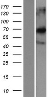 CCDC120 Human Over-expression Lysate