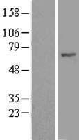 beta TRCP2 (FBXW11) Human Over-expression Lysate