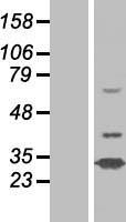 N42L1 (N4BP2L1) Human Over-expression Lysate