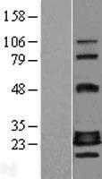 GADD45GIP1 Human Over-expression Lysate