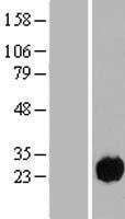 CCDC32 Human Over-expression Lysate