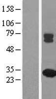 MMAB Human Over-expression Lysate