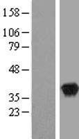 WDR5 Human Over-expression Lysate
