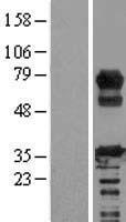 RCSD 1 (RCSD1) Human Over-expression Lysate