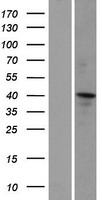 CCDC16 (ZNF830) Human Over-expression Lysate