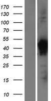 VPS26B Human Over-expression Lysate