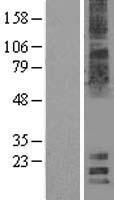 MAL2 Human Over-expression Lysate