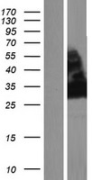 NT5C3L (NT5C3B) Human Over-expression Lysate