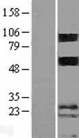 Porimin (TMEM123) Human Over-expression Lysate